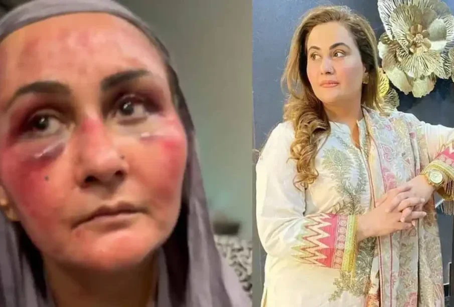 نرگس نے تشدد کیس میں اپنےشوہر کو معاف کردیا