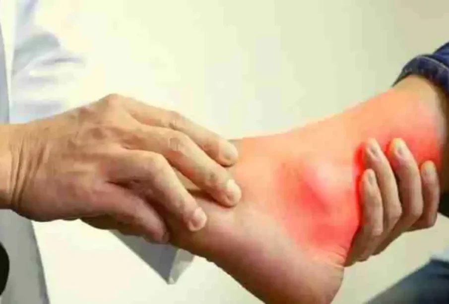 جسم سےیورک ایسڈکم کرنےکےآسان طریقے