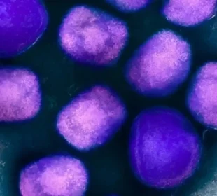 خیبرپختونخوا : رواں برس کا پہلا منکی پاکس کیس رپورٹ