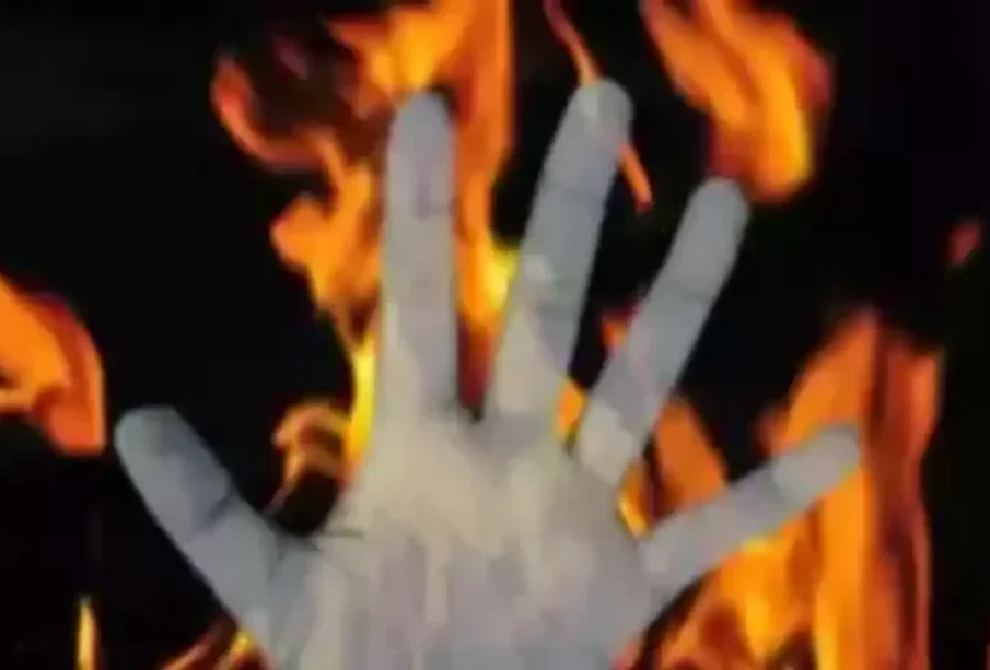 دوستوں کے ساتھ جھگڑےکےبعد12 سالہ یتیم نے خود کو آگ لگادی