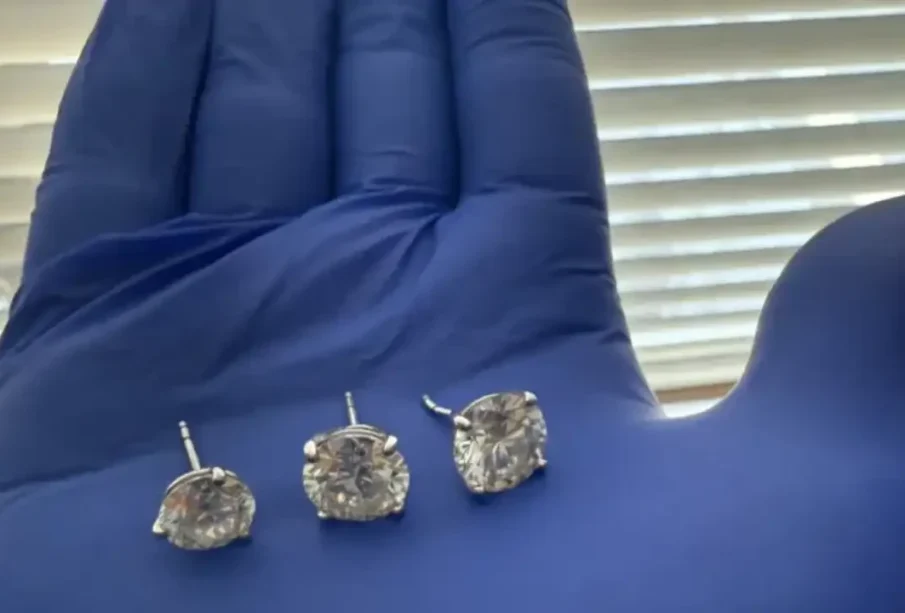 پولیس نےچور کے پیٹ سے 14 کروڑکی بالیاں برآمدکرلیں