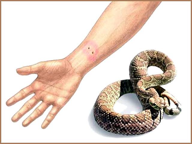 2 دہائیوں تک سانپ کا زہر لگوانے والا شخص 1 2 دہائیوں تک سانپ کا زہر لگوانے والا شخص