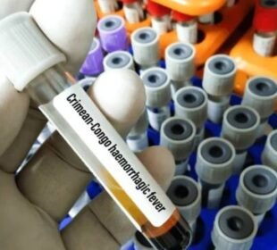 نشتر اسپتال میں کانگو وائرس کی تصدیق