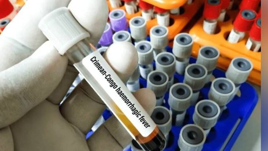 نشتر اسپتال میں کانگو وائرس کی تصدیق