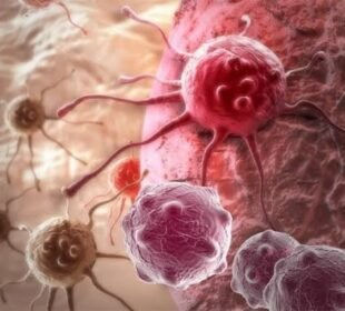 انجیر کا باقاعدہ استعمال کینسر سےبچاؤ میں مددگار