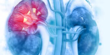 گردوں کی بیماری دنیا کی 10 بڑی جان لیوا بیماریوں میں شامل