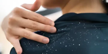 سردیوں میں بڑھتی خشکی کا مؤثر حل: نیم اور آملہ کا ہربل پیک مفید قرار 19 سردیوں میں بڑھتی خشکی کا مؤثر حل: نیم اور آملہ کا ہربل پیک مفید قرار