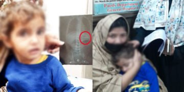 لاہور: تین سالہ بچی کے معدے سے ہیئر پن کامیابی سے نکال لی گئی