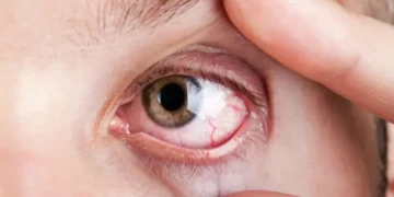 ہائی بلڈ پریشر صرف دل کے لیے نہیں، آنکھوں کے لیے بھی خطرہ