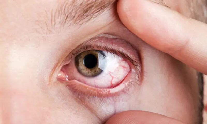 ہائی بلڈ پریشر صرف دل کے لیے نہیں، آنکھوں کے لیے بھی خطرہ