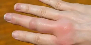 سردیوں میں ہاتھ اور پیر کیوں سوج جاتے ہیں؟