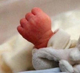 نوزائیدہ بچوں میں پیلیا کا فوری ٹیسٹ اب چند سیکنڈز میں