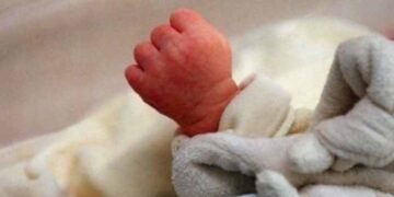 نوزائیدہ بچوں میں پیلیا کا فوری ٹیسٹ اب چند سیکنڈز میں 5 نوزائیدہ بچوں میں پیلیا کا فوری ٹیسٹ اب چند سیکنڈز میں