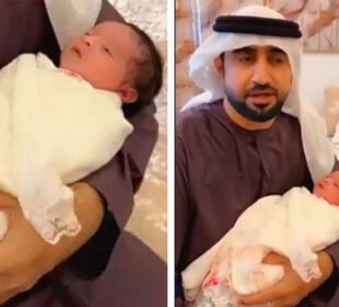 پیدائش کے صرف چھ دن بعد نومولود بچی کے دانت نمودار