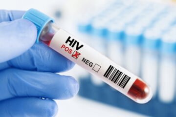 پاکستان میں ایچ آئی وی کیسز میں تیزی سے اضافہ، عالمی اداروں کا فوری اقدامات پر زور