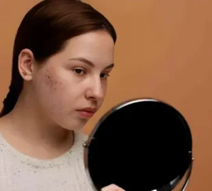 سردیوں میں جلدی مسائل اور کیل مہاسوں کا بڑھنا: وجوہات اور حل