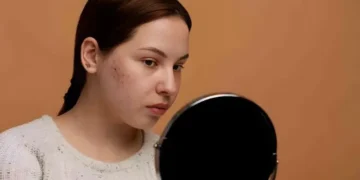 سردیوں میں جلدی مسائل اور کیل مہاسوں کا بڑھنا: وجوہات اور حل