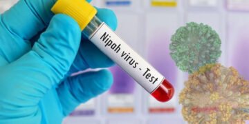 مہلک نیپا وائرس: علامات، علاج اور بچاؤ کے طریقے 37 مہلک نیپا وائرس: علامات، علاج اور بچاؤ کے طریقے