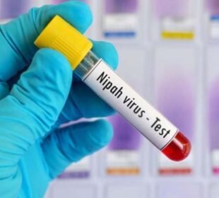 نیپاہ وائرس کی تشخیص کیلئے ٹیسٹنگ کٹس کا بندوبست مکمل