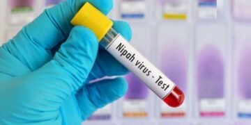 نیپاہ وائرس کی تشخیص کیلئے ٹیسٹنگ کٹس کا بندوبست مکمل