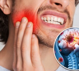 مسوڑھوں کا انفیکشن ملٹی پل سکلیروسز کی شدت بڑھا سکتا ہے، نئی تحقیق