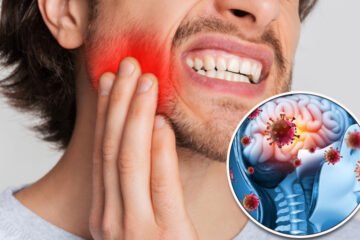 مسوڑھوں کا انفیکشن ملٹی پل سکلیروسز کی شدت بڑھا سکتا ہے، نئی تحقیق