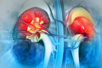 گردوں کی ناکامی: کیسے بچائیں اپنی صحت اور زندگی؟