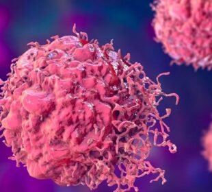 کینسر خاموشی سے کیسے جسم پر قبضہ کرتا ہے؟ چونکا دینے والی وجوہات