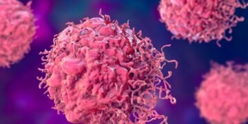 کینسر خاموشی سے کیسے جسم پر قبضہ کرتا ہے؟ چونکا دینے والی وجوہات
