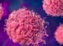 کینسر خاموشی سے کیسے جسم پر قبضہ کرتا ہے؟ چونکا دینے والی وجوہات