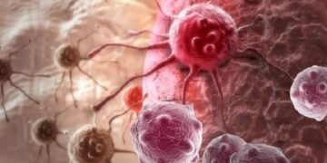 روبوٹک سرجری کے ذریعے لبلبے کے کینسر کا کامیاب آپریشن