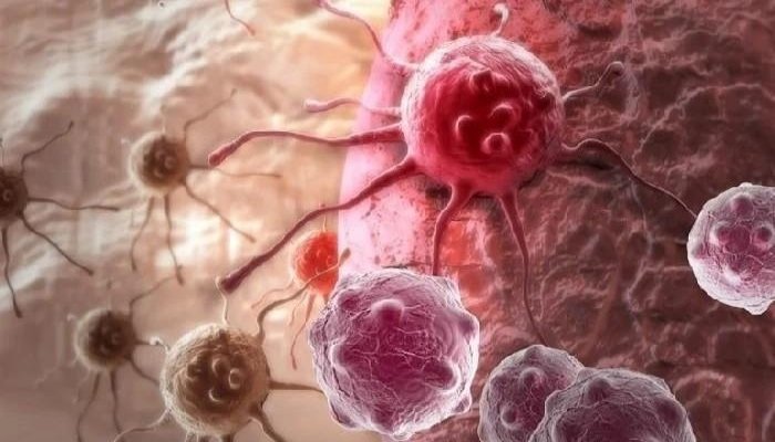 روبوٹک سرجری کے ذریعے لبلبے کے کینسر کا کامیاب آپریشن 1 روبوٹک سرجری کے ذریعے لبلبے کے کینسر کا کامیاب آپریشن