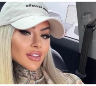 پلاسٹک سرجری کے 18 دن بعد 27 سالہ انفلوئنسر کی دل دہلا دینے والی موت