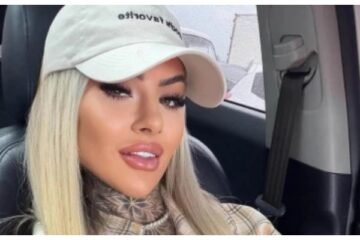 پلاسٹک سرجری کے 18 دن بعد 27 سالہ انفلوئنسر کی دل دہلا دینے والی موت 2 پلاسٹک سرجری کے 18 دن بعد 27 سالہ انفلوئنسر کی دل دہلا دینے والی موت