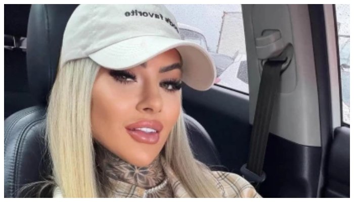 پلاسٹک سرجری کے 18 دن بعد 27 سالہ انفلوئنسر کی دل دہلا دینے والی موت 1 پلاسٹک سرجری کے 18 دن بعد 27 سالہ انفلوئنسر کی دل دہلا دینے والی موت