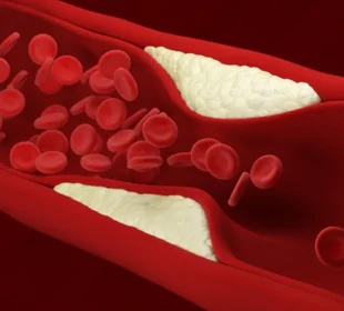 شریانوں میں چکنائی سے بچاؤ کے آسان طریقے