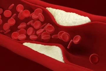 شریانوں میں چکنائی سے بچاؤ کے آسان طریقے