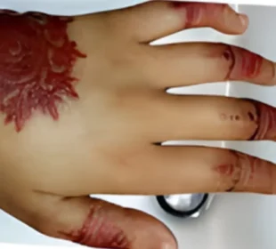 مہندی کے انتخاب میں محتاط رہنے کی ہدایت