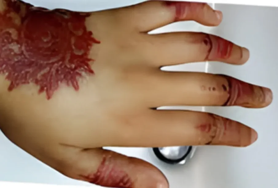 مہندی کے انتخاب میں محتاط رہنے کی ہدایت