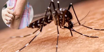 مچھر آپ کو ہی زیادہ کیوں کاٹتے ہیں؟ سائنس نے راز کھول دیا