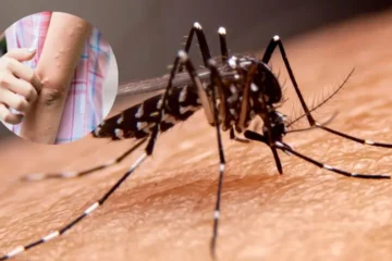مچھر آپ کو ہی زیادہ کیوں کاٹتے ہیں؟ سائنس نے راز کھول دیا 2 مچھر آپ کو ہی زیادہ کیوں کاٹتے ہیں؟ سائنس نے راز کھول دیا
