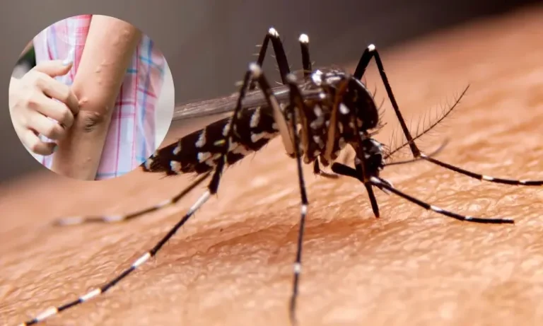 26122000مچھر آپ کو ہی زیادہ کیوں کاٹتے ہیں؟ سائنس نے راز کھول دیا7c90d36