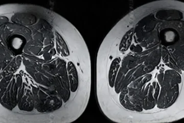 الٹرا پروسیسڈ غذاؤں کے پٹھوں اور مجموعی صحت پر سنگین اثرات 2 الٹرا پروسیسڈ غذاؤں کے پٹھوں اور مجموعی صحت پر سنگین اثرات