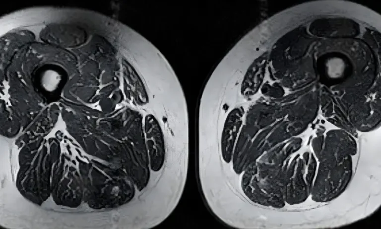 15123الٹرا پروسیسڈ غذاؤں کے پٹھوں اور مجموعی صحت پر سنگین اثرات0229989e1d