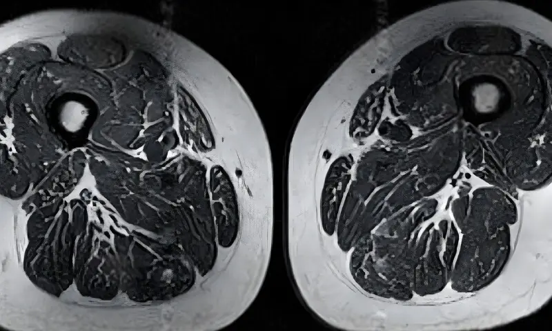 الٹرا پروسیسڈ غذاؤں کے پٹھوں اور مجموعی صحت پر سنگین اثرات