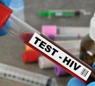 اسلام آباد میں ایچ آئی وی کیسز میں تشویشناک اضافہ، سرکاری اعداد و شمار جاری