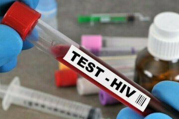 اسلام آباد میں ایچ آئی وی کیسز میں تشویشناک اضافہ، سرکاری اعداد و شمار جاری