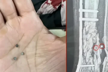 لبنان اور غزہ میں مبینہ مہلک دھاتی ذرات والے ہتھیاروں کے استعمال کا انکشاف
