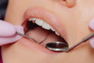 مسوڑھوں کی دائمی سوزش اور زرخیزی کے درمیان ممکنہ تعلق، نئی تحقیق سامنے آ گئی
