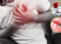اسٹنٹ لگوانے کے بعد بھی دل کا دورہ پڑ سکتا ہے؟ ماہرین نے اہم حقائق بتا دیے 6 اسٹنٹ لگوانے کے بعد بھی دل کا دورہ پڑ سکتا ہے؟ ماہرین نے اہم حقائق بتا دیے
